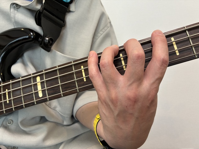 4指独立手の甲1